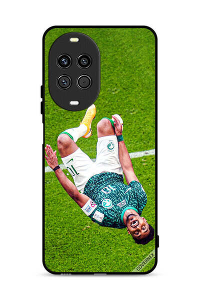 Covernex غطاء حماية لهاتف هواوي نوفا 14 ألترا 5G من سالم الدوسري