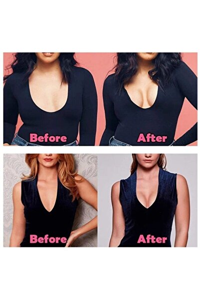 C&City Συσκευασία 2 τεμαχίων ταινίας για ανύψωση και διαμόρφωση στήθους