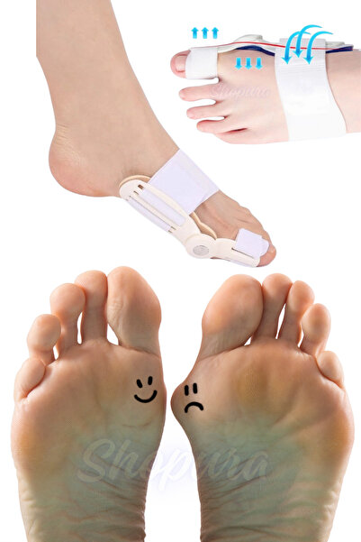 Shopura Halluks Valgus Gece Ateli Düzeltici Ayak Baş Parmak Kemik Çıkıntısı D...