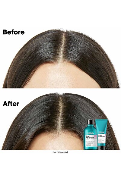 L'oreal Professionnel L'Oréal Professionnel Scalp Advanced Anti-Discomfort Intensive Treatment, Niacinamide, 200 ml