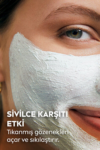 NIVEA Sivilce Karşıtı Beyaz Kil Maskesi 150 ml,Gözenek ve Siyah Nokta Arındırıcı,Tüm Cilt Tipleri
