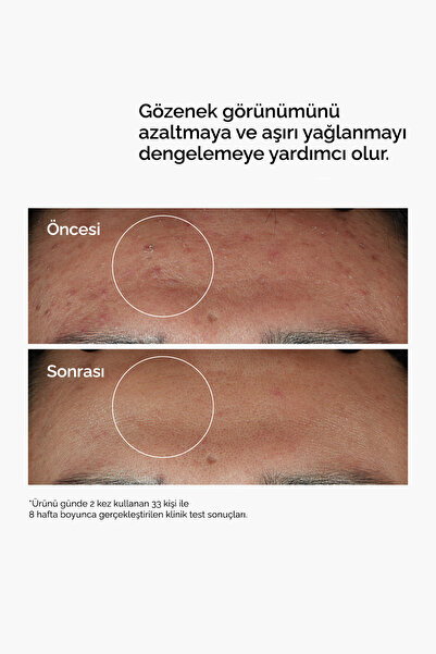 The Ordinary Niacinamide 10% + Zinc 1% - Leke ve Gözenek Görünümü Karşıtı Serum 30ml