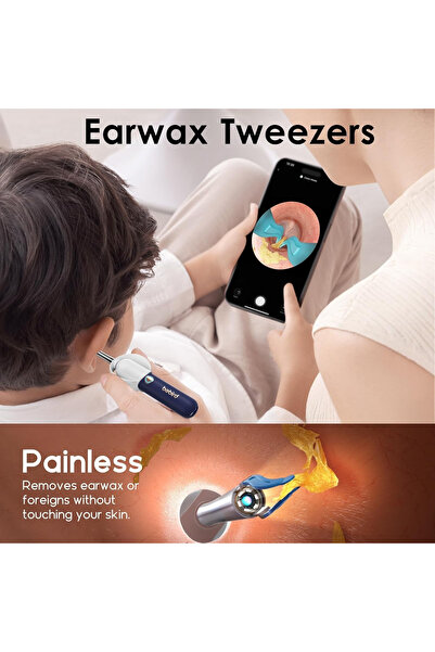 Bebird EarSight Plus Flexible Otoscope Light - Ear Wax Removal Tools with Camera