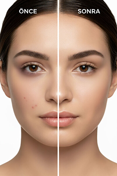 Golden Rose Just Touch Liquid Concealer 01 E Vitamini, Niacinamide, Likit Kapatıcı 3,5 ml