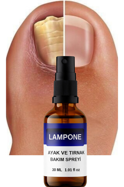 Lampone Ayak Ve Tırnak Mantar, Kaşıma Ve Koku Için Sprey 30 ml Bitkisel Bakım ve Ferahlık Desteği