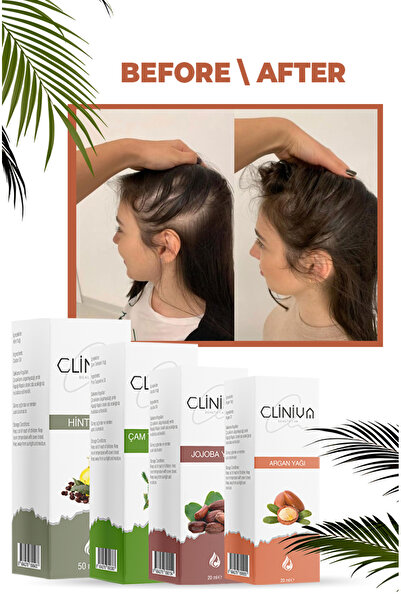 cliniva Saç Dökülmesine Karşı 4’lü Organik Yağ Seti | Çam Terebentin, Hint, Argan, Jojoba