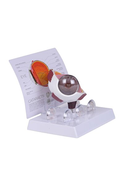 EgeAnatomi Maketleri Katarakt Göz Modeli - Göz Maketi