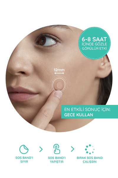 Stick On Spots S.o.s Mixy | 24’lü Yüz Için Sivilce/akne Bandı–4 Boy Pimple Patch-hidrokolloid Bant