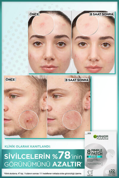 Garnier Pimple Patch 22'li Sivilce Bandı / Hidrokolloid Bant / Akne Karşıtı 22li Bant