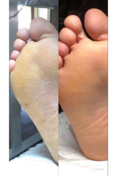 Michelle Laville Ayak Ve Topuk Çatlak Onarım Kremi | Ayak Kokusu Giderici | Ayak Bakımı 100ml