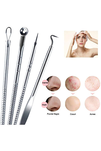 NEO Set of 4 Tweezers for Extracting Blackheads, Pimples, Acne, Comedones, Neo™ Premium, stainless steel, metal