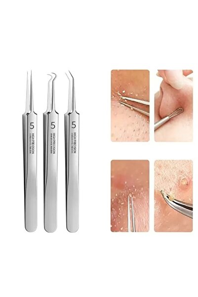 NEO Set of 5 blackhead extraction tweezers, stainless steel cosmetic tools, metal, acne, comedones