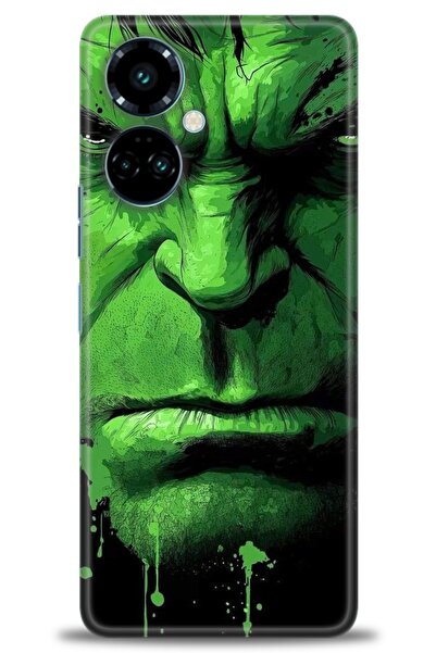 kılıfevreni حافظة متوافقة مع هاتف Tecno Camon 19 Pro + واقي شاشة سيراميك غير ...