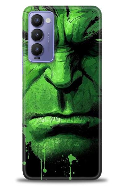 kılıfevreni حافظة متوافقة مع هاتف Tecno Camon 18P + واقي شاشة سيراميك غير قاب...