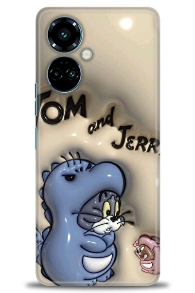 kılıfevreni حافظة متوافقة مع هاتف Tecno Camon 19 Pro + واقي شاشة سيراميك غير ...