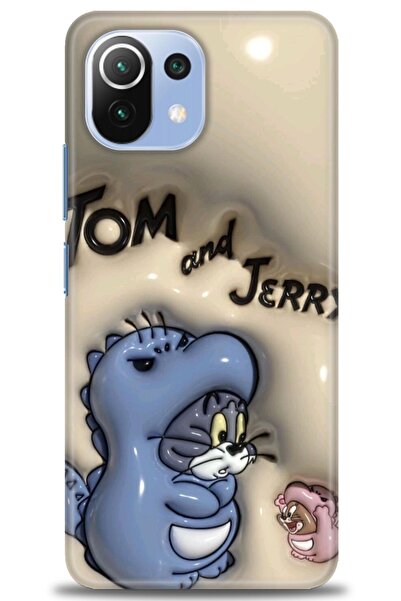 kılıfevreni غطاء متوافق مع هاتف Xiaomi Mi 11 Lite A+ Plus HD مطبوع - غطاء من ...