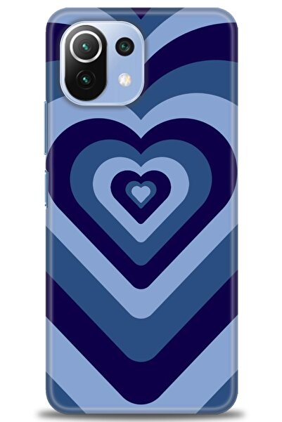 kılıfevreni غطاء متوافق مع هاتف Xiaomi Mi 11 Lite A+ Plus HD مطبوع - غطاء من ...