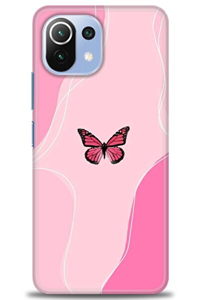 kılıfevreni غطاء متوافق مع هاتف Xiaomi Mi 11 Lite A+ Plus غطاء HD مطبوع - غطا...