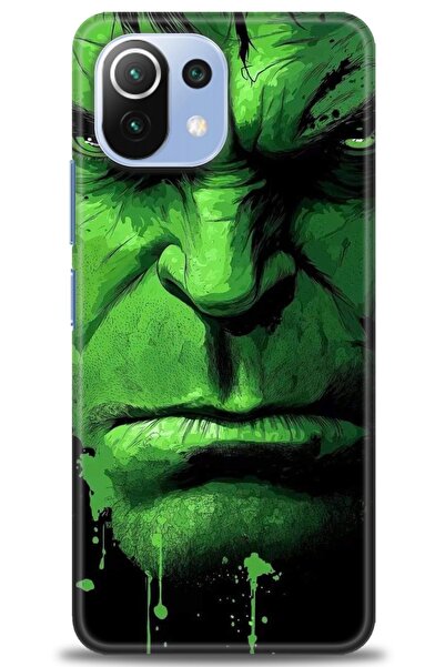 kılıfevreni غطاء متوافق مع هاتف Xiaomi Mi 11 Lite A+ Plus غطاء HD مطبوع - غطا...