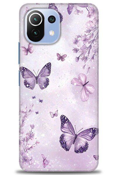 kılıfevreni غطاء متوافق مع هاتف Xiaomi Mi 11 Lite A+ Plus غطاء HD مطبوع - غطا...