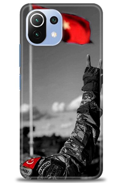 kılıfevreni غطاء متوافق مع هاتف Xiaomi Mi 11 Lite A+ Plus غطاء HD مطبوع - غطا...