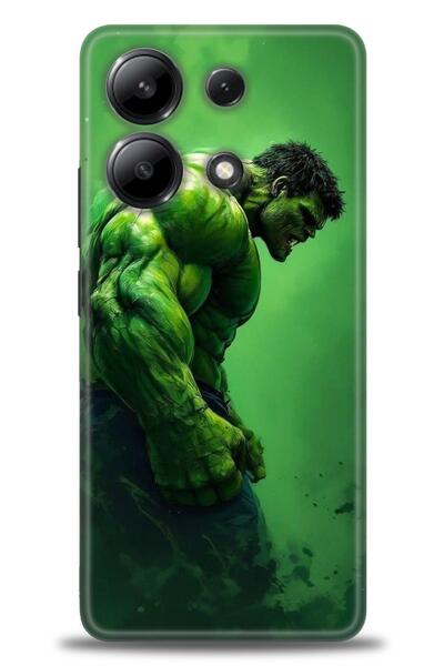 kılıfevreni جراب متوافق مع هاتف Xiaomi Redmi Note 13 4G A+ Plus + واقي شاشة س...