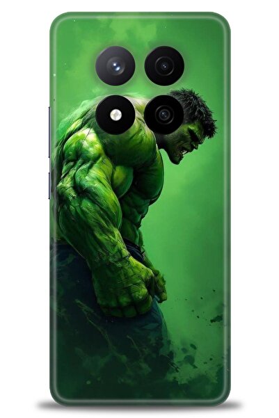 kılıfevreni جراب متوافق مع هاتف Xiaomi Redmi Note 14 Pro Plus + واقي شاشة سير...