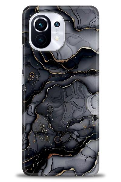 kılıfevreni حافظة متوافقة مع هاتف Xiaomi Mi 11 A+ Plus + واقي شاشة من السيرام...