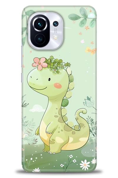 kılıfevreni حافظة متوافقة مع هاتف Xiaomi Mi 11 + واقي شاشة من السيراميك غير ق...