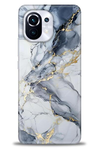 kılıfevreni جراب متوافق مع هاتف Xiaomi Mi 11 A+ Plus + واقي شاشة سيراميك غير ...