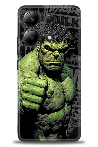 kılıfevreni جراب متوافق مع هاتف Xiaomi Redmi Note 13 4G A+ Plus + واقي شاشة س...