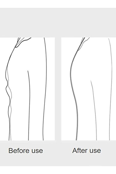 Fstyle Invisible Clothes Tighteners 36 Piece Set