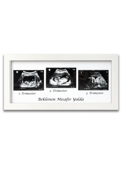 Moky Design Bebek Ultrason Fotoğraf Çerçevesi 3'lü Triemester, Sonogram Anı Ç...