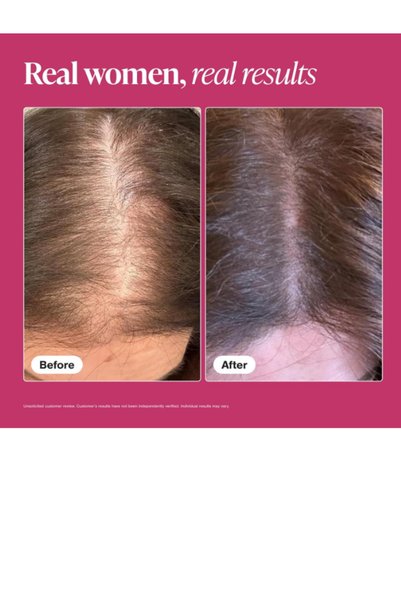 viviscal Advanced Hair Health Hair Growth Supplement 60 Tablets