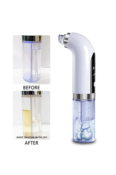 NEO Συσκευή Υδροδερμοαπόξεσης Neo™ Hidra Premium, για ενυδάτωση και καθαρισμό, αφαίρεση λεκέδων