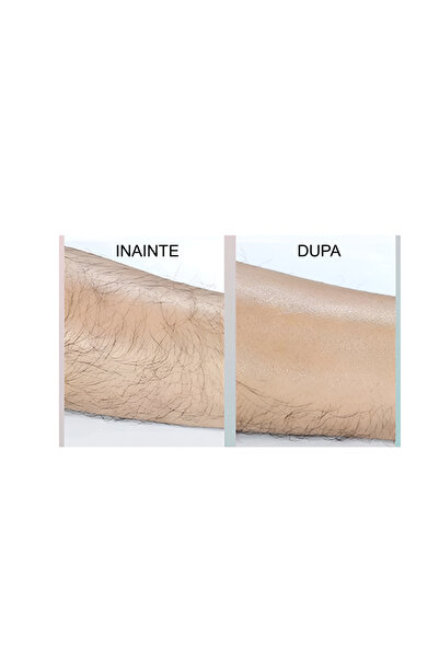 NEO Αποτριχωτική Μηχανή Κρυστάλλων, για Αποτρίχωση Μακράς Διάρκειας, Ροζ, Neo™