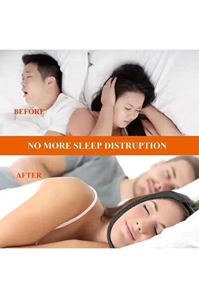 UYDEE Horlama Bandı Çene Kapatma Bandajı Uyku Aparatı Horlama Önleyici Çene Kemeri