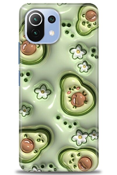 kılıfevreni غطاء متوافق مع هاتف Xiaomi Mi 11 Lite A+ Plus غطاء HD مطبوع - غطا...