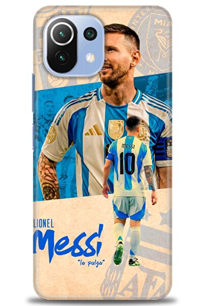 kılıfevreni غطاء متوافق مع هاتف Xiaomi Mi 11 Lite A+ Plus HD مطبوع - غطاء من ...