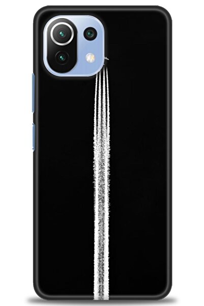 kılıfevreni غطاء متوافق مع هاتف Xiaomi Mi 11 Lite A+ Plus HD مطبوع - غطاء من ...