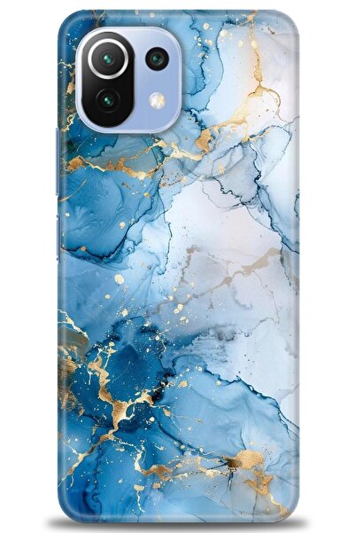 kılıfevreni غطاء متوافق مع هاتف Xiaomi Mi 11 Lite A+ Plus غطاء HD مطبوع - غطا...