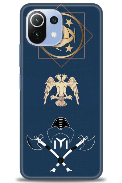 kılıfevreni غطاء متوافق مع هاتف Xiaomi Mi 11 Lite A+ Plus HD مطبوع - غطاء من ...