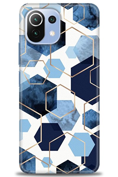 kılıfevreni غطاء متوافق مع هاتف Xiaomi Mi 11 Lite A+ Plus HD مطبوع - غطاء سيل...