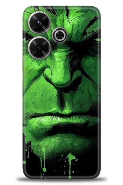 kılıfevreni جراب متوافق مع هاتف Xiaomi Redmi 13 4G A+ Plus + واقي شاشة سيرامي...