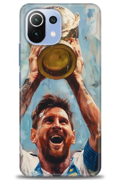 kılıfevreni غطاء متوافق مع هاتف Xiaomi Mi 11 Lite A+ Plus HD مطبوع - غطاء من ...