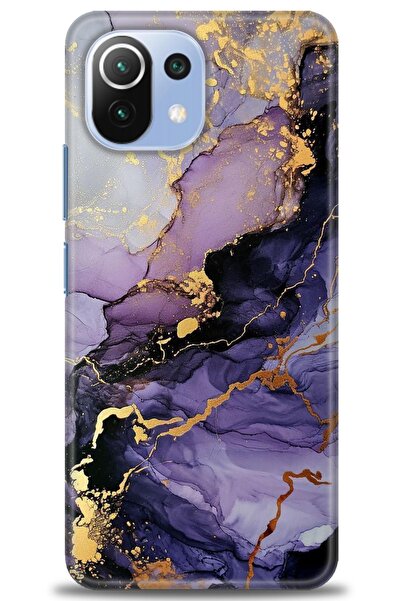 kılıfevreni غطاء متوافق مع هاتف Xiaomi Mi 11 Lite A+ Plus غطاء HD مطبوع - غطا...