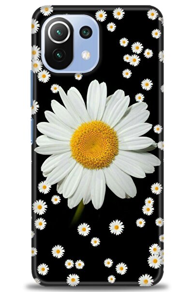 kılıfevreni غطاء متوافق مع هاتف Xiaomi Mi 11 Lite A+ Plus غطاء HD مطبوع - غطا...