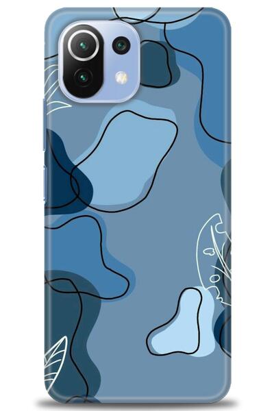 kılıfevreni غطاء متوافق مع هاتف Xiaomi Mi 11 Lite A+ Plus غطاء HD مطبوع - غطا...