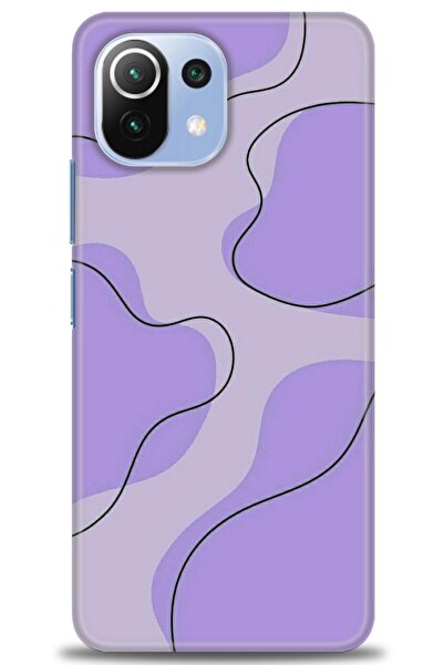 kılıfevreni غطاء متوافق مع هاتف Xiaomi Mi 11 Lite A+ Plus HD مطبوع - غطاء من ...