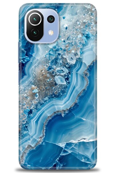 kılıfevreni غطاء متوافق مع هاتف Xiaomi Mi 11 Lite A+ Plus HD مطبوع - غطاء من ...